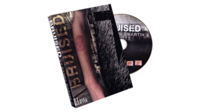 Bruised by Daniel Martin Bruised by Daniel Martin