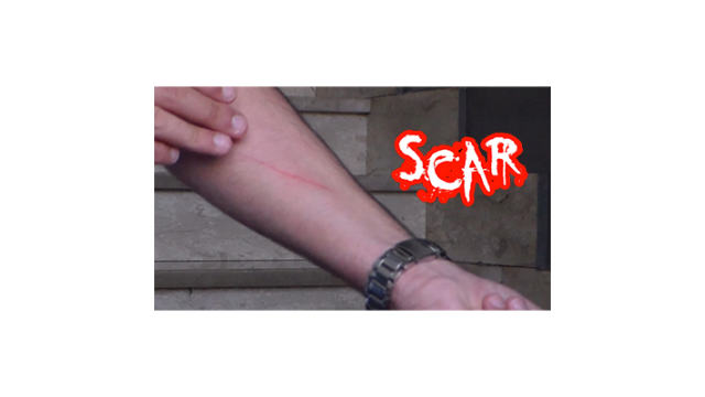 Scar by Dan Alex Scar by Dan Alex