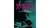 X-Ray by Ben Harris & Steve Shufton X-Ray by Ben Harris & Steve Shufton