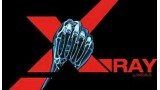 X-Ray by Rasmus X-Ray by Rasmus