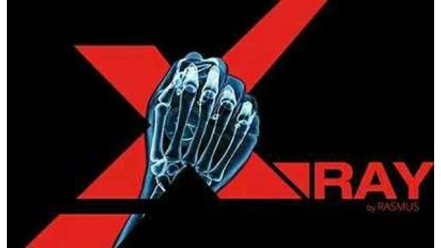 X-Ray by Rasmus X-Ray by Rasmus